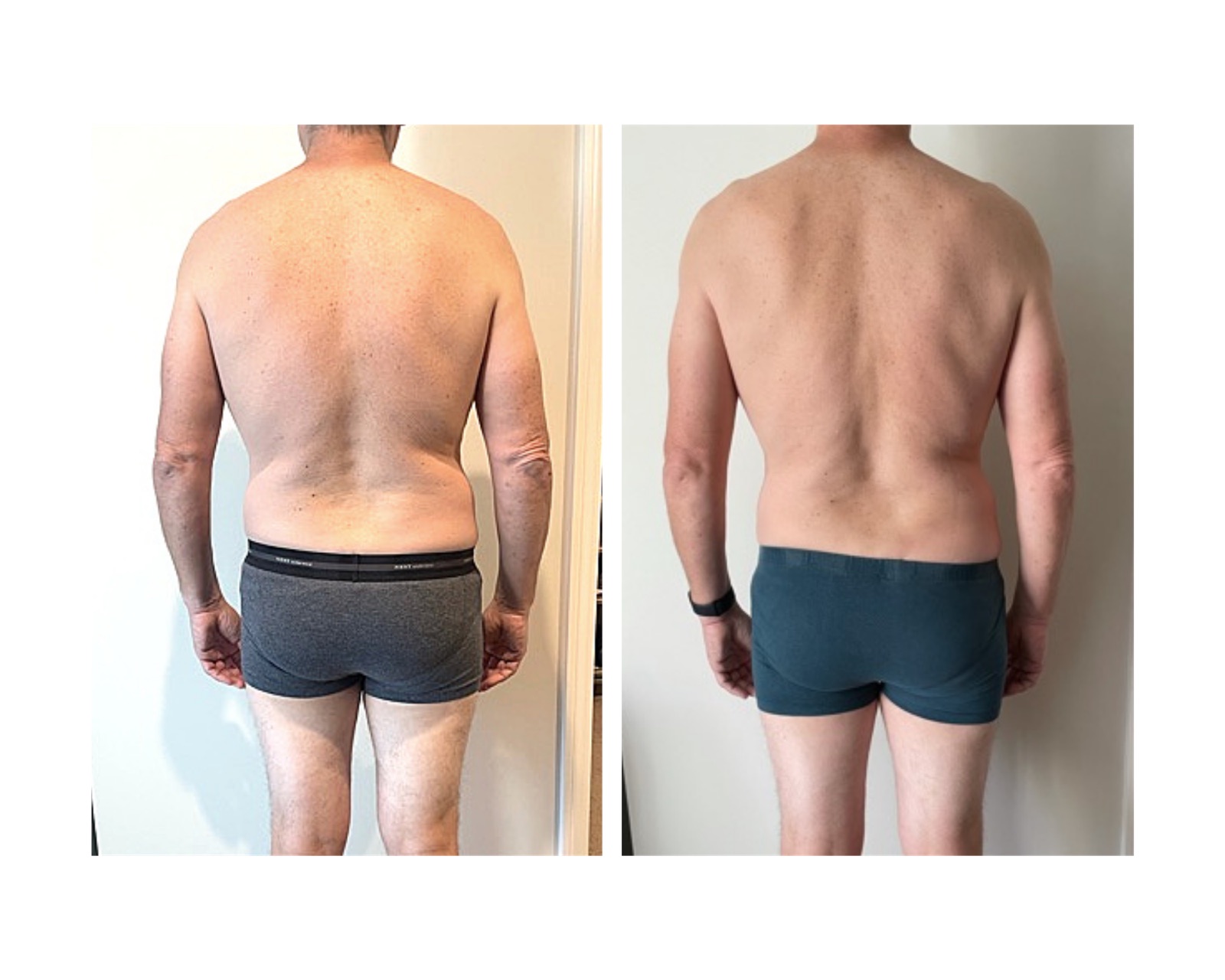 Back-view client progress